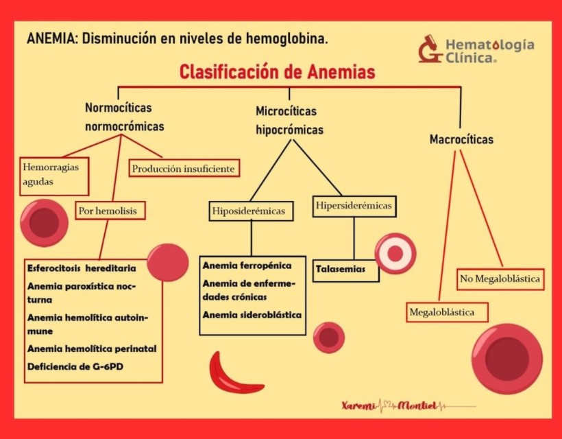 Anemias. Clasificación Y Diagnóstico | Pediatría Integral